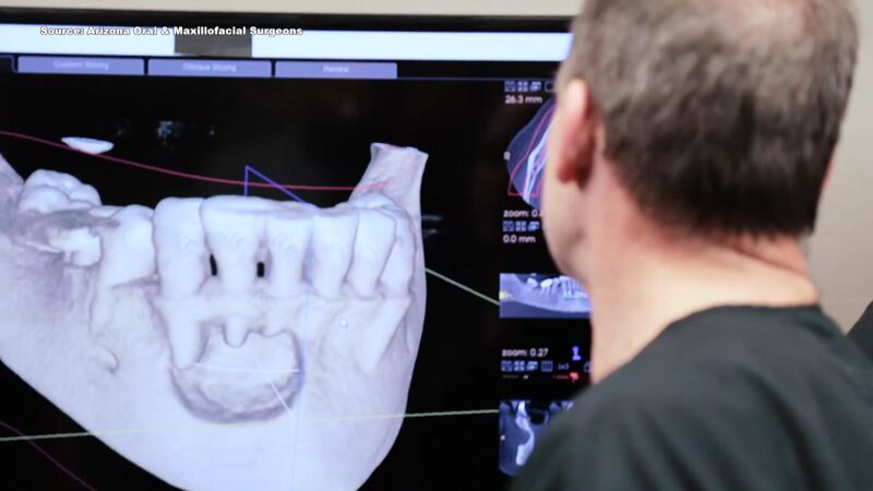 A dental surgeon looks at an image of a patient's mandible on Wednesday, March 18, 2020....